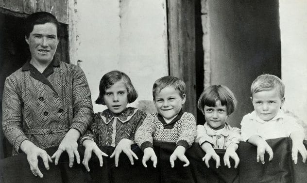 ../T3/Ectrodactyly-Family-1930.jpg